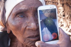 Hệ thống giúp chẩn đoán thị lực bằng… smartphone